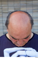 Street  785 bald head 0001.jpg